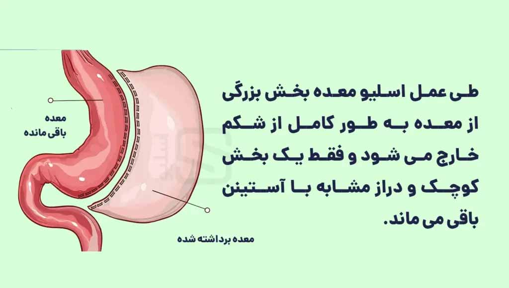 8 دلیل که چرا خانم ها به سختی وزن کم می کنند!