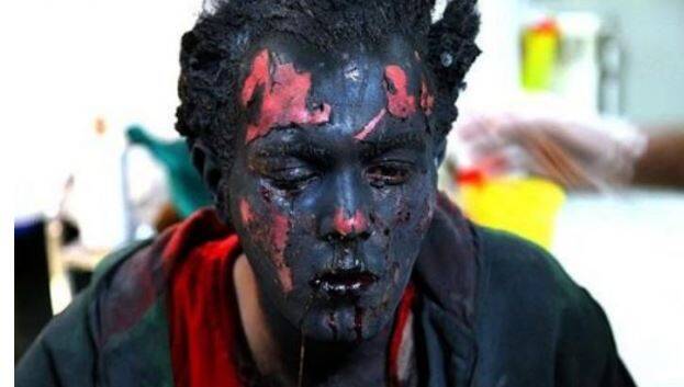 یک لحظه شادی، یک عمر حسرت و پشیمانی/ ۱۷ فوتی و ۷۱۴ مصدوم در حوادث چهارشنبهسوری امسال/۸۰ مورد قطع عضو،  ۲۰۸ مورد آسیب به چشم، ۲۴۹ مورد سوختگی +عکس و فیلم