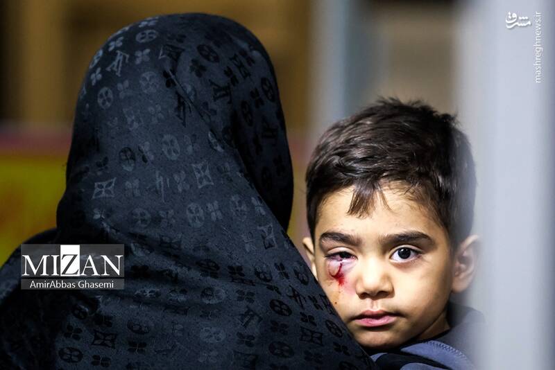 عکس/مصدومان چهارشنبه سوری ۱۴۰۱