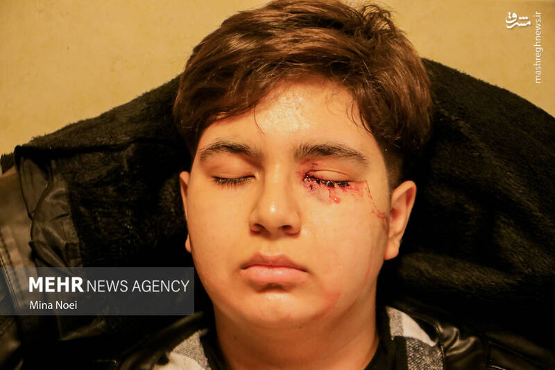 عکس/ مصدومین آخرین چهارشنبه سال ۱۴۰۱ در تبریز (۱۸+)