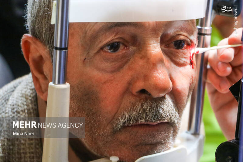 عکس/ مصدومین آخرین چهارشنبه سال ۱۴۰۱ در تبریز (۱۸+)