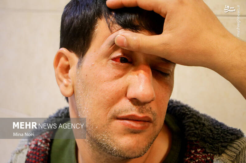 عکس/ مصدومین آخرین چهارشنبه سال ۱۴۰۱ در تبریز (۱۸+)