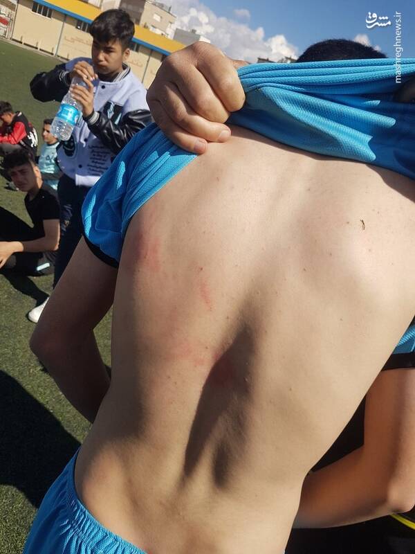 چاقو و قمه کشی در لیگ نونهالان +عکس