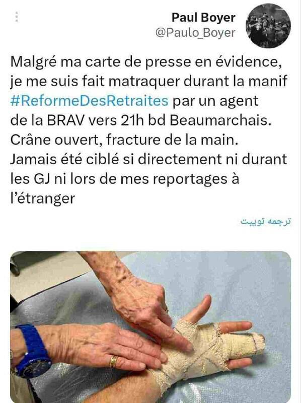 شکستن دست و جمجمه خبرنگار توسط پلیس فرانسه