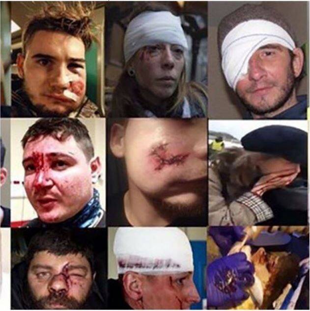 شهرهای فرانسه صحنه خون و مرگ و عصیان! عکس و فیلم