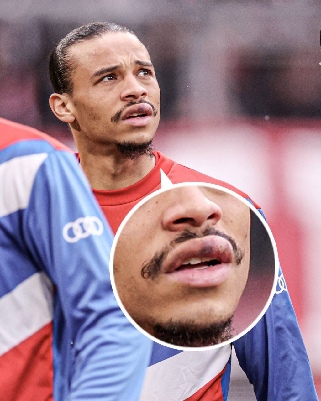 آثار درگیری با مانه روی صورت سانه سوژه عکاسان شد +عکس