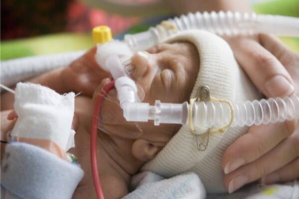 تاریخهای رُند و احتمال مرگ نوزادان نارس