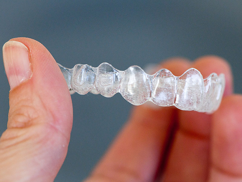 با انواع ارتودنسی نامرئی آشنا شوید