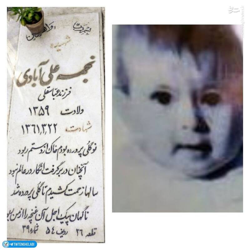 کودک ۲ ساله ای که توسط منافقین زنده زنده سوخت