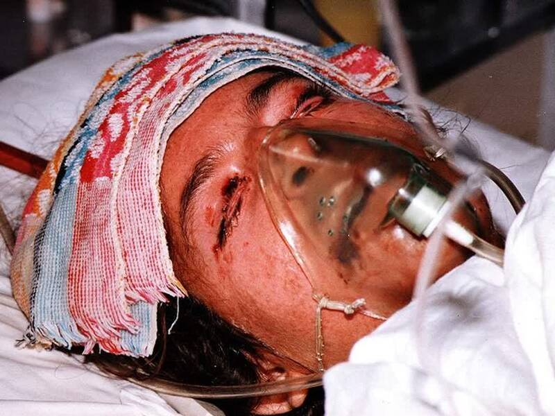 چرا هیچوقت آلمان درمورد جنایت حمله شیمیایی به ایران پاسخگو نشد؟ +فیلم و تصاویر