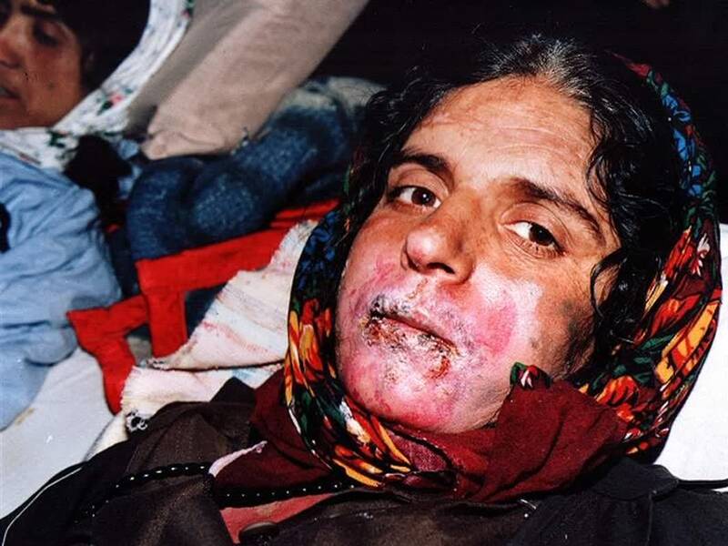 چرا هیچوقت آلمان درمورد جنایت حمله شیمیایی به ایران پاسخگو نشد؟ +فیلم و تصاویر