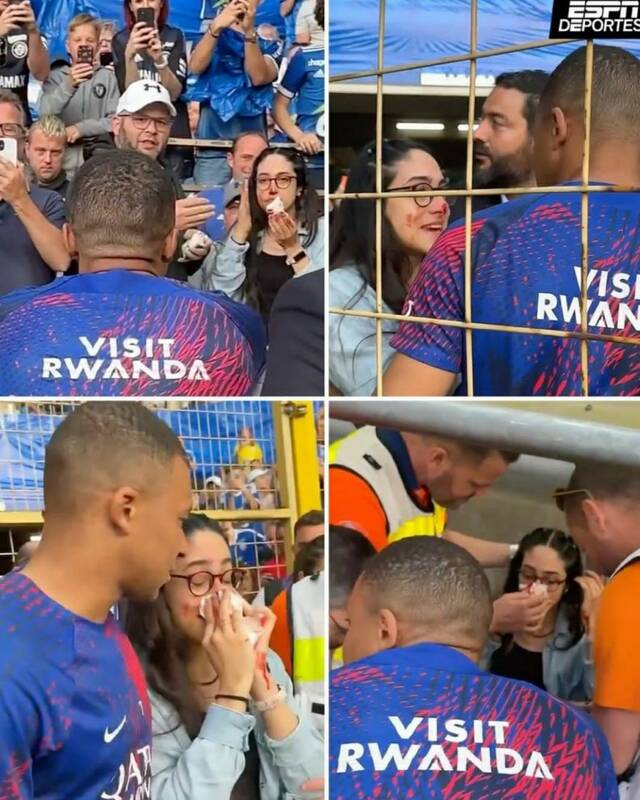 بلایی که شوت امباپه بر سر صورت یک زن جوان آورد +عکس