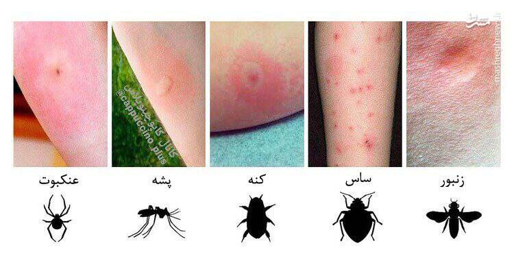عکس/ با انواع نیش حشرات آشنا شوید