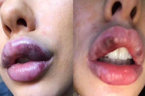 جذب مشتری «جراحی زیبایی» با تصاویر فتوشاپی!