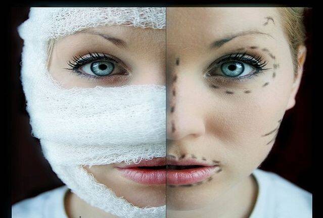 جذب مشتری «جراحی زیبایی» با تصاویر فتوشاپی!