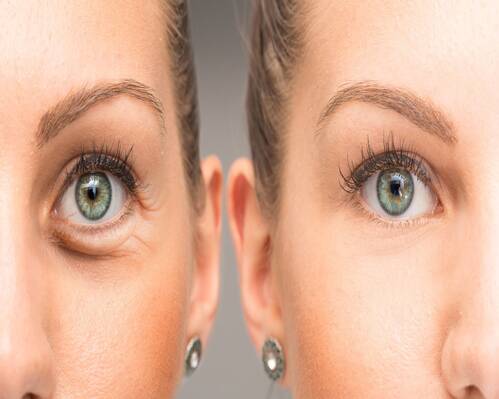 جذب مشتری «جراحی زیبایی» با تصاویر فتوشاپی!