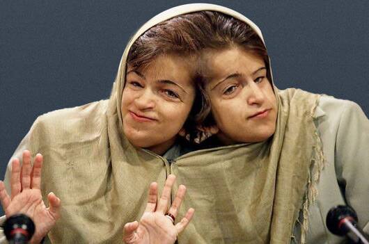 ماجرای ۱۱ دیدار پدر دوقلوهای به هم چسبیده با امام(ره) +تصاویر و فیلم