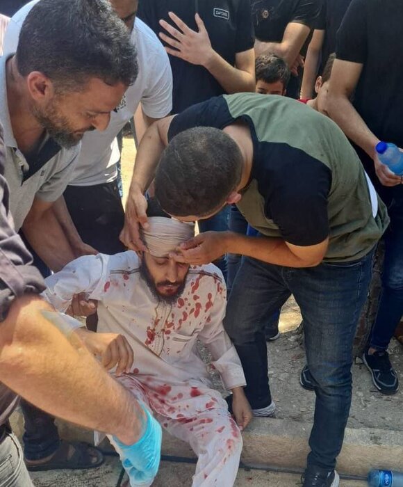 حمله نظامیان صهیونیست به نمازگزاران فلسطینی +عکس