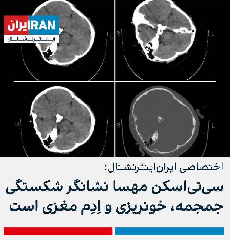 اعتراف براندازان به دروغ بودن ضربوشتم مهسا امینی + عکس 2