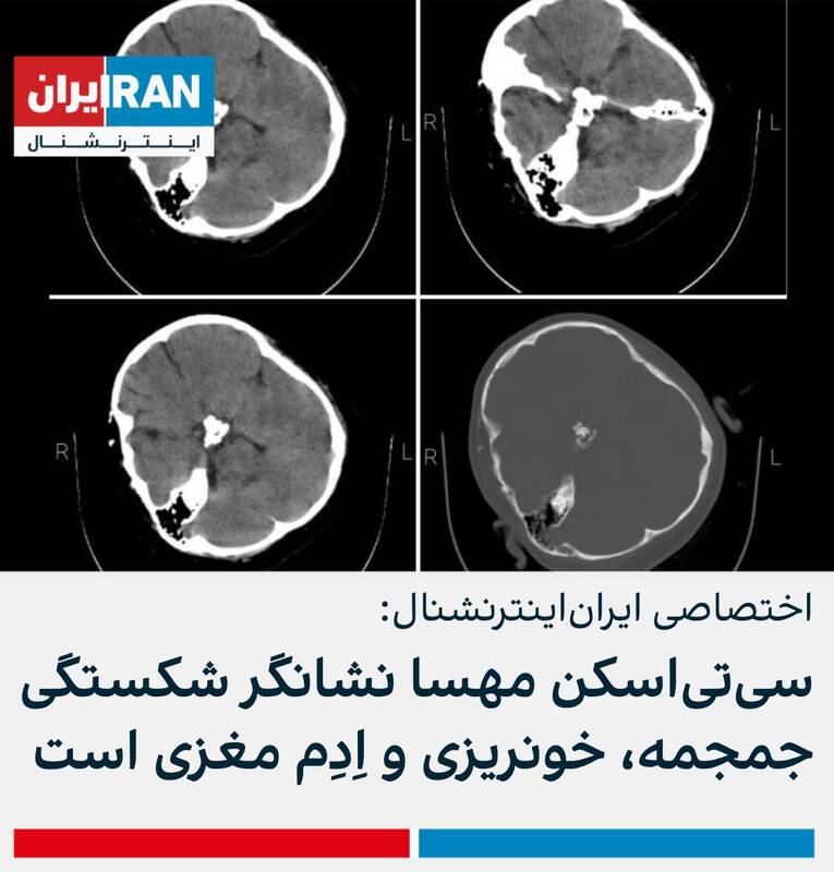 یک سال دروغ در شبکه‌ای که خودش را پربیننده‌ترین می‌داند+ عکس و فیلم