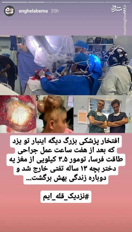 خارج کردن تومور ۳.۵ کیلویی از سر یک دختر بچه در یزد +عکس