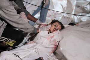 نسل کُشی در غزه به روایت تصویر 18+