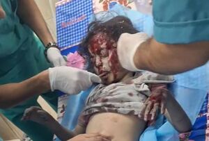 بمباران کودکان فلسطینی در اردوگاه النصیرات
