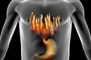 چند روش ساده برای کاهش سوزش معده چند روش ساده برای کاهش سوزش معده