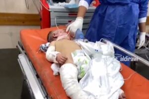 زخمی شدن تعدادی نوزاد شیرخواره در بمباران شب گذشته غزه