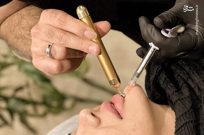 جراحی زیبایی زیر دستِ سلبریتی در اتاق عمل رسانه