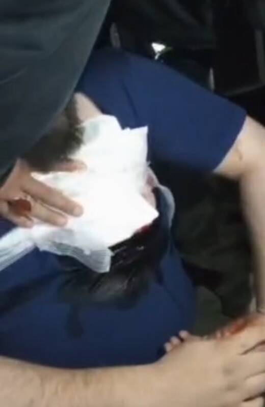 حمله مزاحمین ناموس به دو آمر به معروف با چاقو +عکس