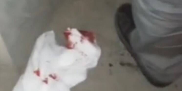 حمله مزاحمین ناموس به دو آمر به معروف با چاقو +عکس