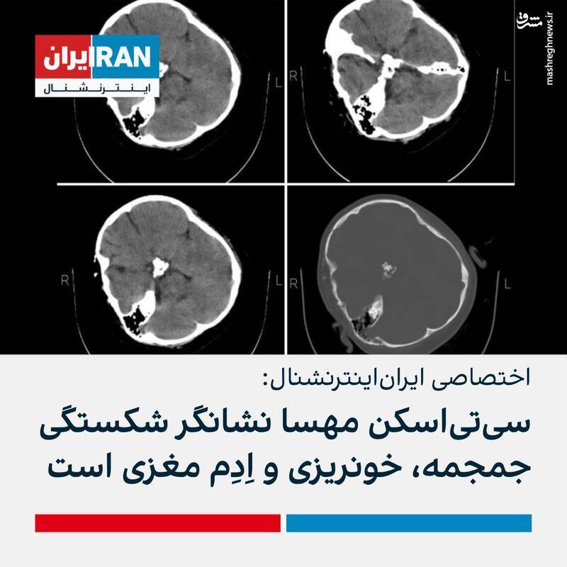 شبکه اینترنشنال هک شد!/ جعل ناشیانه خبر قدیمی برای سریالسازی از « مهسا و آرمیتا» +عکس و فیلم