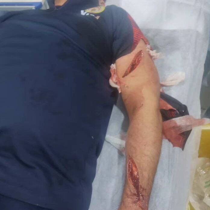 قمه کشی در لیگ فوتبال ایران با دو مجروح +فیلم