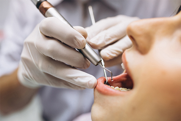 نکات مهم در درمان ارتودنسی دندان