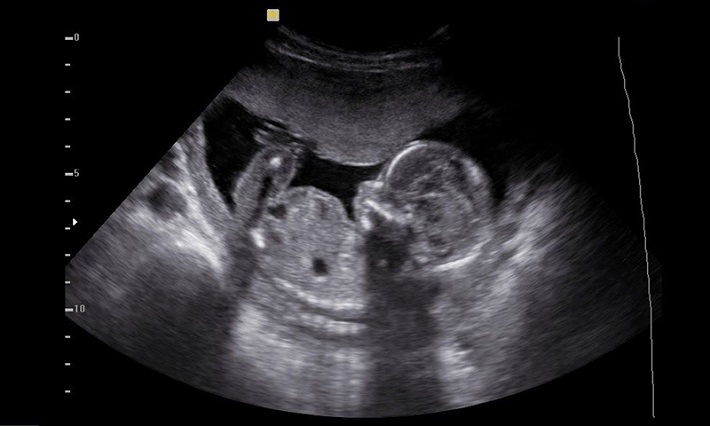 ارائه کاملترین خدمات تخصصی غربالگری