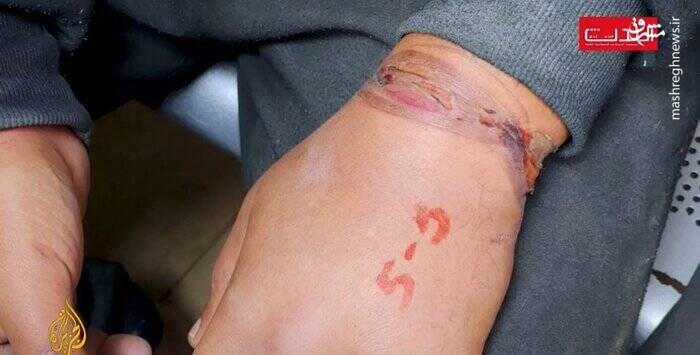 شکنجه اسرای فلسطینی با کابل برق+ عکس