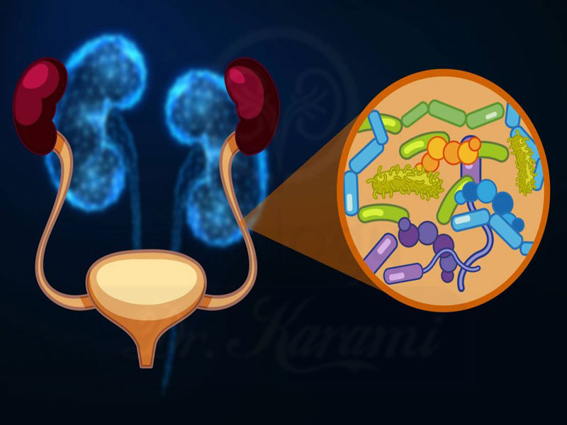 روش های درمان عفونت کلیه و مجاری ادرار بدون مراجعه حضوری
