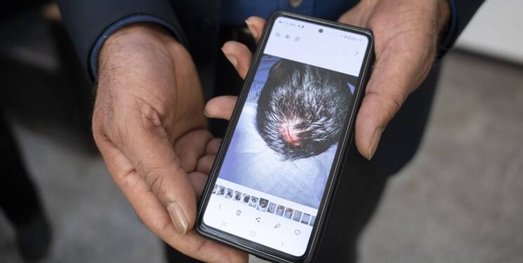 شکافتن سر جوان ۲۰ ساله برای دزدیدن گوشی+ فیلم