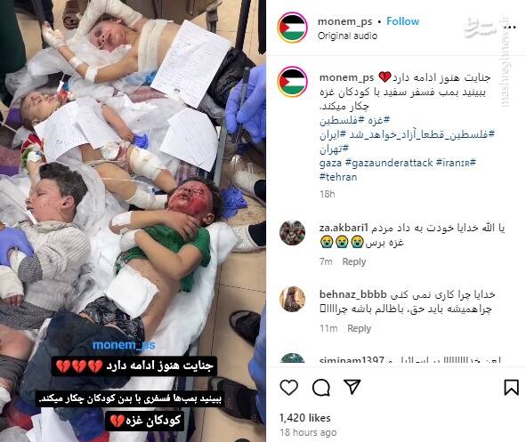 ببینید بمب فسفر با کودکان غزه چه کار میکند