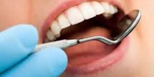 مهمترین عامل جلوگیری کننده از پوسیدگی دندان