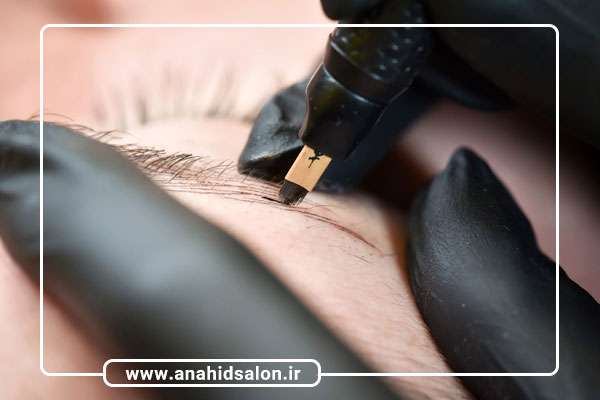 ماندگاری و دوام فیبروز ابرو چقدر است؟