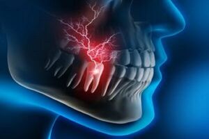 بهترین داروها برای التیام دندان درد کدامند؟