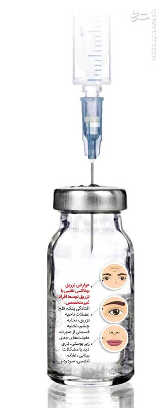 پاتک ترکیهای به بوتاکس ایرانی