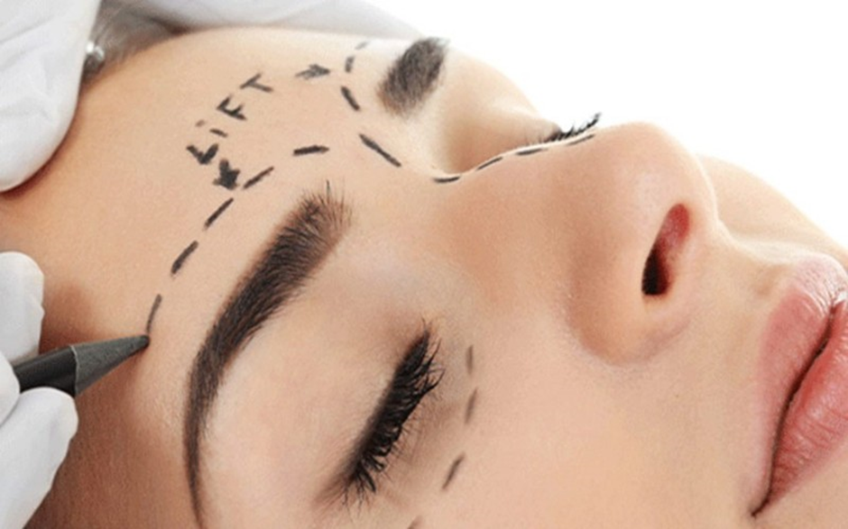 دایرکت ابرو (لیفت دایرکت ابرو) چیست؟ مزایا، ماندگاری و هزینه