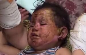 زخمی شدن کودک فلسطینی در اردوگاه البریج