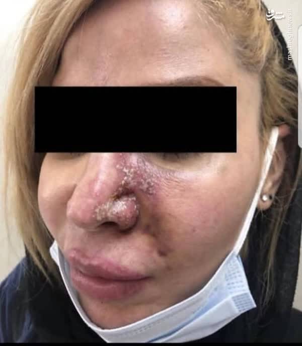 جراحی زیبایی در منزل! +عکس