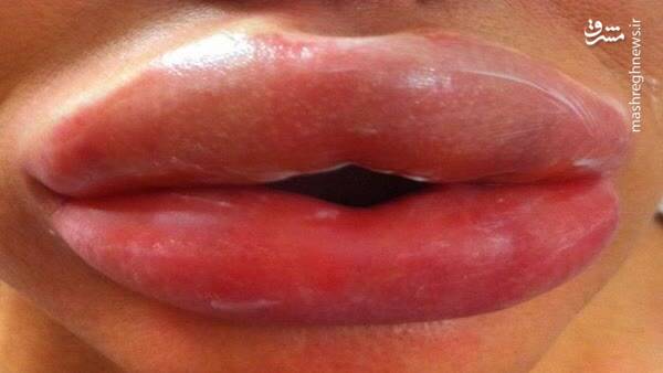 جراحی زیبایی در منزل! +عکس