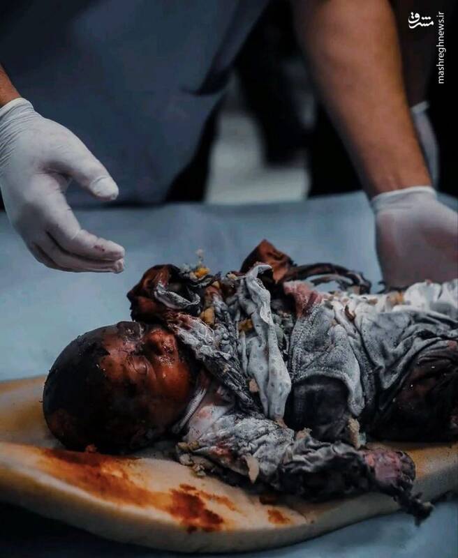 تصاویر جنایات جدید اسرائیل در غزه +۱۸