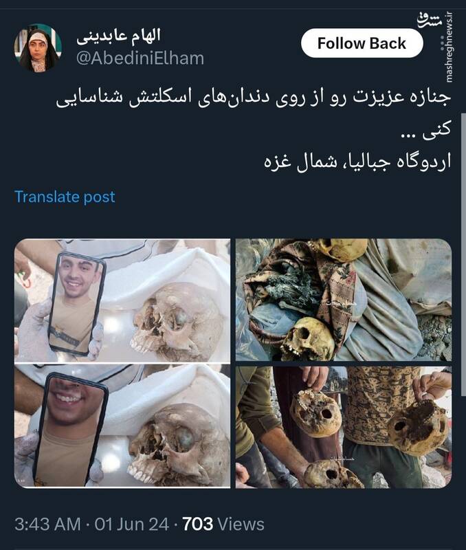 جنازه عزیزت رو از روی دندانهای اسکلتش شناسایی کنی